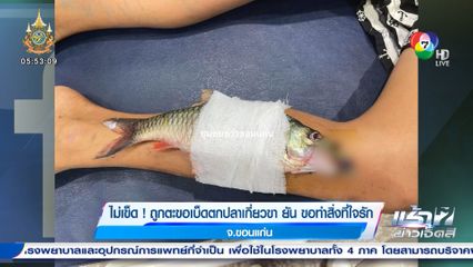 ไม่เข็ด! ถูกตะขอเบ็ดตกปลาเกี่ยวขา ยัน ขอทำสิ่งที่ใจรัก จ.ขอนแก่น