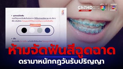 ดรามาหนักกฎวันรับปริญญา ห้ามใช้อุปกรณ์จัดฟันสีฉูดฉาด