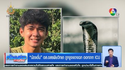 น้องอั๋น อส.อสรพิษวิทยา ถูกงูจงอางฉก ออกจาก ICU