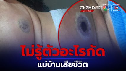 แม่บ้านไม่รู้ตัวอะไรกัด เป็นแผลบวม ป่วยซึม สุดท้ายเสียชีวิต