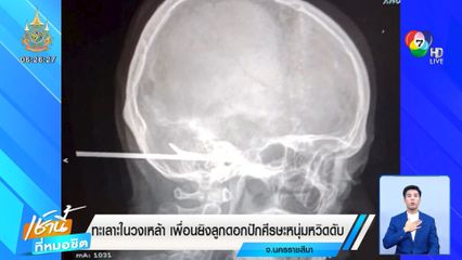 ทะเลาะในวงเหล้า เพื่อนยิงลูกดอกปักศีรษะหนุ่มหวิดดับ