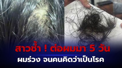 สาวสุดช้ำ ! ต่อผมมา 5 วัน เกิดอาการคัน ผมร่วงจนคนคิดว่าเป็นโรค