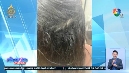 สาวปาดน้ำตา ต่อผมเสร็จ ผมร่วงหนักมาก