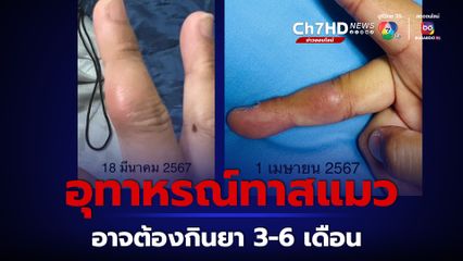 หมอมนูญยกเคสเตือนช่วย แมวจร โดนกัดติดเชื้อรา โรคสปอโรทริโคซิส