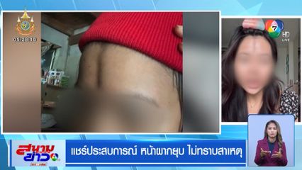 แชร์ประสบการณ์ หน้าผากยุบ ไม่ทราบสาเหตุ  แถมยังไม่มีวิธีรักษา 