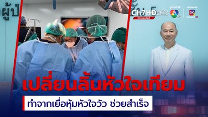 หมออารักษ์เผยเคสผ่าเปลี่ยนลิ้นหัวใจเทียมทำจากเยื่อหุ้มหัวใจวัว
