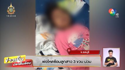 พ่อโหดซ้อมลูกสาว 3 ขวบ น่วม