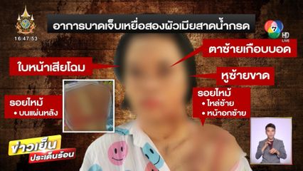 โดนคุก 25 ปี! ผัว-เมียสาดน้ำกรดสาว ม.6 ชดใช้เงิน 2 ล้าน