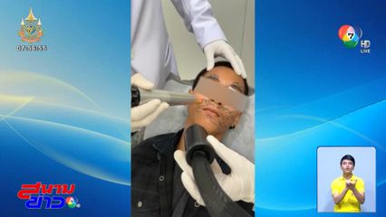 สิ้นสุดการรอคอย ! ลบรอยสักหน้ายักษ์หนุ่มบุรีรัมย์