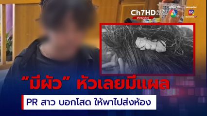 มีผัวหัวเลยมีแผล! นักร้องหนุ่ม ถูกแฟน PR ซัดน่วม หลังสาวบอกโสด ให้พาไปส่งห้อง