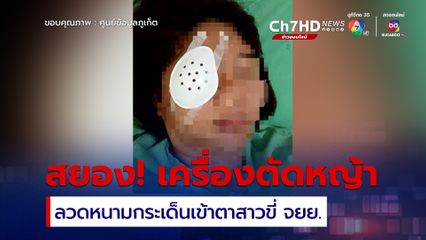 สุดเสี่ยว! คนตัดหญ้าเศษลวดหนามกระเด็นเข้าตาสาวขี่ จยย.ผ่าน