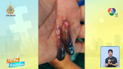 พ่อค้าซื้อปลาทะเลน้ำลึก ได้ของแถม