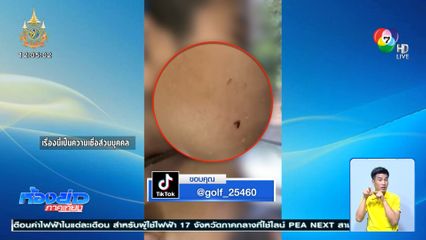 แปลก! หนอนโผล่ออกมาจากหน้า