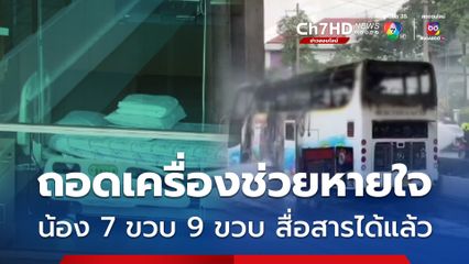 น้อง 7 ขวบ 9 ขวบ ถอดเครื่องช่วยหายใจ แผลไฟไหม้ไม่พบการติดเชื้อ