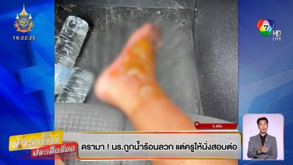 ดรามา ! นร.ถูกน้ำร้อนลวก แต่ครูให้นั่งสอบต่อ