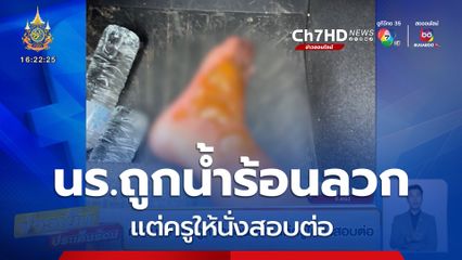 ดรามา ! นร.ถูกน้ำร้อนลวก แต่ครูให้นั่งสอบต่อ