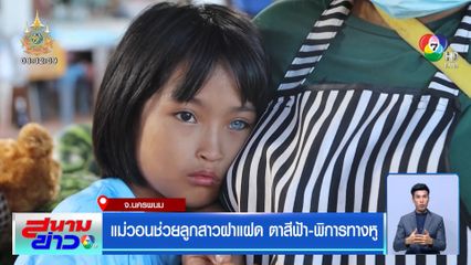 แม่วอนช่วยลูกสาวฝาแฝด ตาสีฟ้า-พิการทางหู