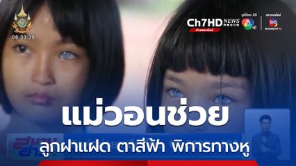 แม่วอนช่วยลูกสาวฝาแฝด ตาสีฟ้า-พิการทางหู
