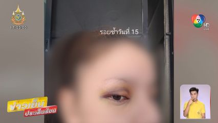 สาวพีอาร์ร้องถูก หนุ่มแว่น ทำร้าย