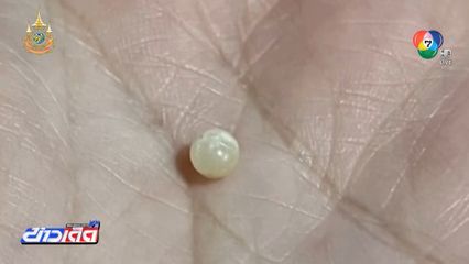 เจออัญมณีหายาก ในหอยหวาน