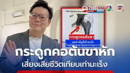 กระดูกคอต้นขาหัก เสี่ยงเสียชีวิตเทียบเท่ามะเร็ง