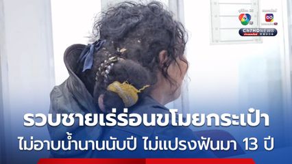 สอบสวนไปเหม็นไป! รวบชายเร่ร่อนขโมยกระเป๋า ไม่ได้อาบน้ำนานนับปี-ไม่แปรงฟันมา 13 ปี