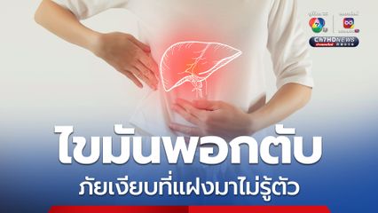 หมอเจดโพสต์เตือน ไขมันพอกตับภัยเงียบที่แฝงมาไม่รู้ตัว