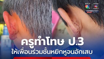 ครูทำโทษ ป.3 ให้เพื่อนร่วมชั้นหยิกหูจนอักเสบ