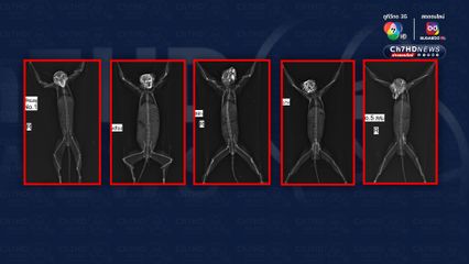 ผ่าตัดลุล่วงช่วยกระรอกบิน 5 ตัว ถูกคนใจร้ายหักขาทั้ง 4 ข้าง เตรียมย่างไฟ