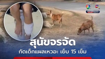 สุนัขจรจัด กัดหนูน้อยวัย 10 ขวบแผลเหวอะ เย็บ 15 เข็ม พ่อวอนหน่วยงานแก้ไข