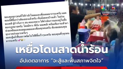 เหยื่อโดนสาดน้ำร้อน โพสต์ขอบคุณกำลังใจ อัปเดตอาการแผลตอนนี้ดีขึ้น