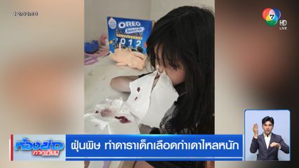 ฝุ่นพิษ ทำดาราเด็กเลือดกำเดาไหลหนัก