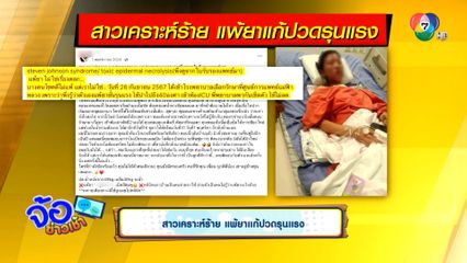 สาวเคราะห์ร้าย แพ้ยาแก้ปวดรุนแรง