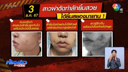 สาวผ่าตัดลักยิ้มนาน 2 เดือน แผลยังไม่หาย