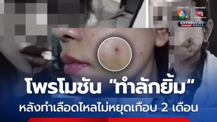 สาวเจอโพรโมชันในแอปฯดัง ทำลักยิ้ม 2 ข้าง ราคาพิเศษ 2,300 บาท หลังตัดสินใจทำ เลือดไหลจากรอยที่ทำลักยิ้มไม่หยุดเกือบ 2 เดือน