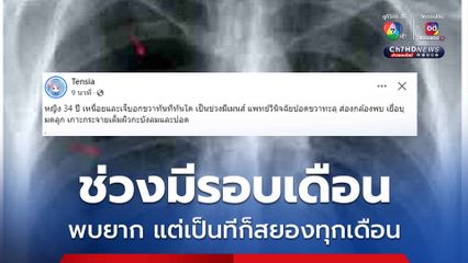 ภาวะปอดรั่ว ช่วงมีรอบเดือน ผู้ป่วยมีอการเหนื่อย เจ็บอกขวาทันทีทันใด