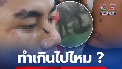 3 วัยรุ่นเข้าแจ้งความ สห.คุมงานวัด กระน่ำตี เตะจนบาดเจ็บ หลังมีเรื่องเขม่นหน้าเวทีคอนเสิร์ตกับวัยรุ่นอีกกลุ่ม