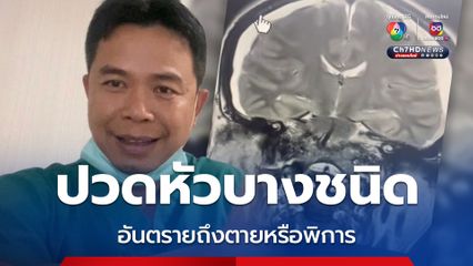 ปวดหัวบางชนิดอันตราย หมอแนะเช็กลิสต์ 12 ข้อ