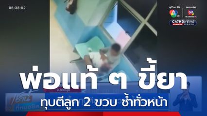 พ่อแท้ ๆ ขี้ยาทุบตีลูกชาย 2 ขวบ ช้ำทั่วหน้า