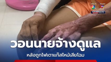 สาวอดีตลูกจ้างร้านข้าวมันไก่ ร้องนายจ้างไม่เยียวยาตามสัญญา หลังถูกไฟจากเตาแก๊สลุกไหม้ตัวเสียโฉม