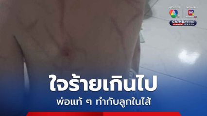 ต้นอ้อเป็นหนึ่งอาสาช่วย น้อง 6 ขวบ ถูกพ่อเจ้าอารมณ์ทำร้าย
