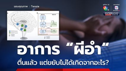อาการ "ผีอำ" ตื่นแล้ว แต่ขยับไม่ได้เกิดจากอะไร?