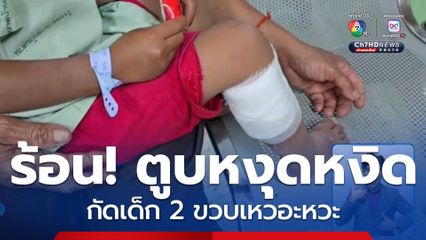 อากาศร้อน! ตูบหงุดหงิด กัดเด็ก 2 ขวบเหวอะหวะ