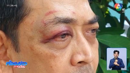 ปลัด อบต.ขอย้าย หลังเกิดเหตุลอบทำร้าย