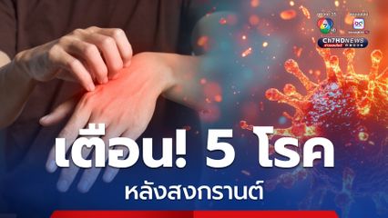 เตือน! 5 โรคหลังสงกรานต์ สังเกตร่างกาย หากมีอาการรีบพบแพทย์