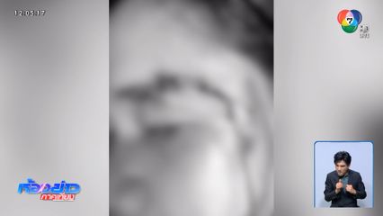 ถูกกล่าวหาว่าลักทรัพย์ ฟาดด้วยของแข็ง