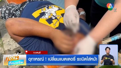 อุทาหรณ์! เปลี่ยนแบตเตอรี่ ระเบิดใส่หน้า