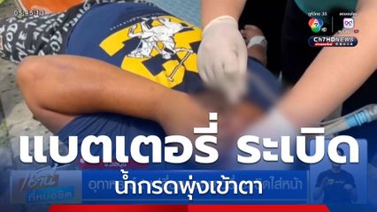 อุทาหรณ์! เปลี่ยนแบตเตอรี่ ระเบิดใส่หน้า