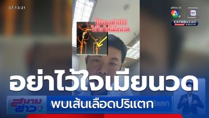 อุทาหรณ์ภรรยานวดคอ เส้นเลือดปริแตก