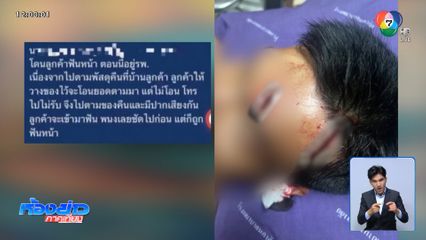 ยังไม่แจ้งข้อหา หนุ่มฟันหัวไรเดอร์